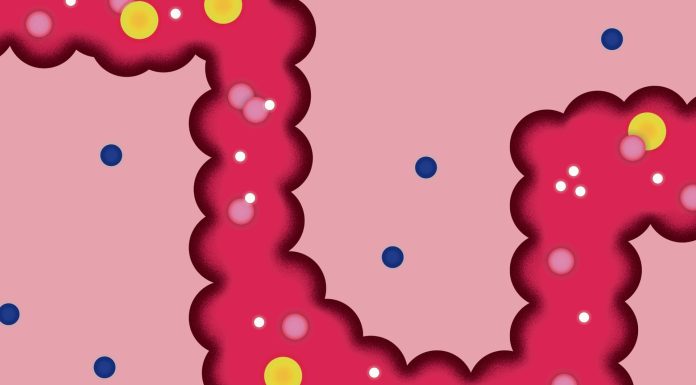 Diverticulitis: the debilitating bowel disorder that’s weakening our guts